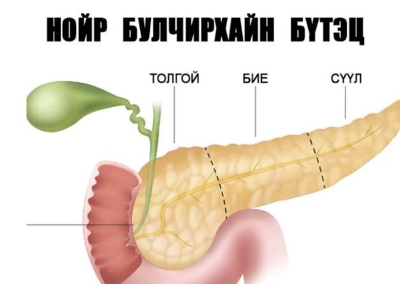 Хүүхдүүд нойр булчирхайн үрэвслээр өвчилж байна