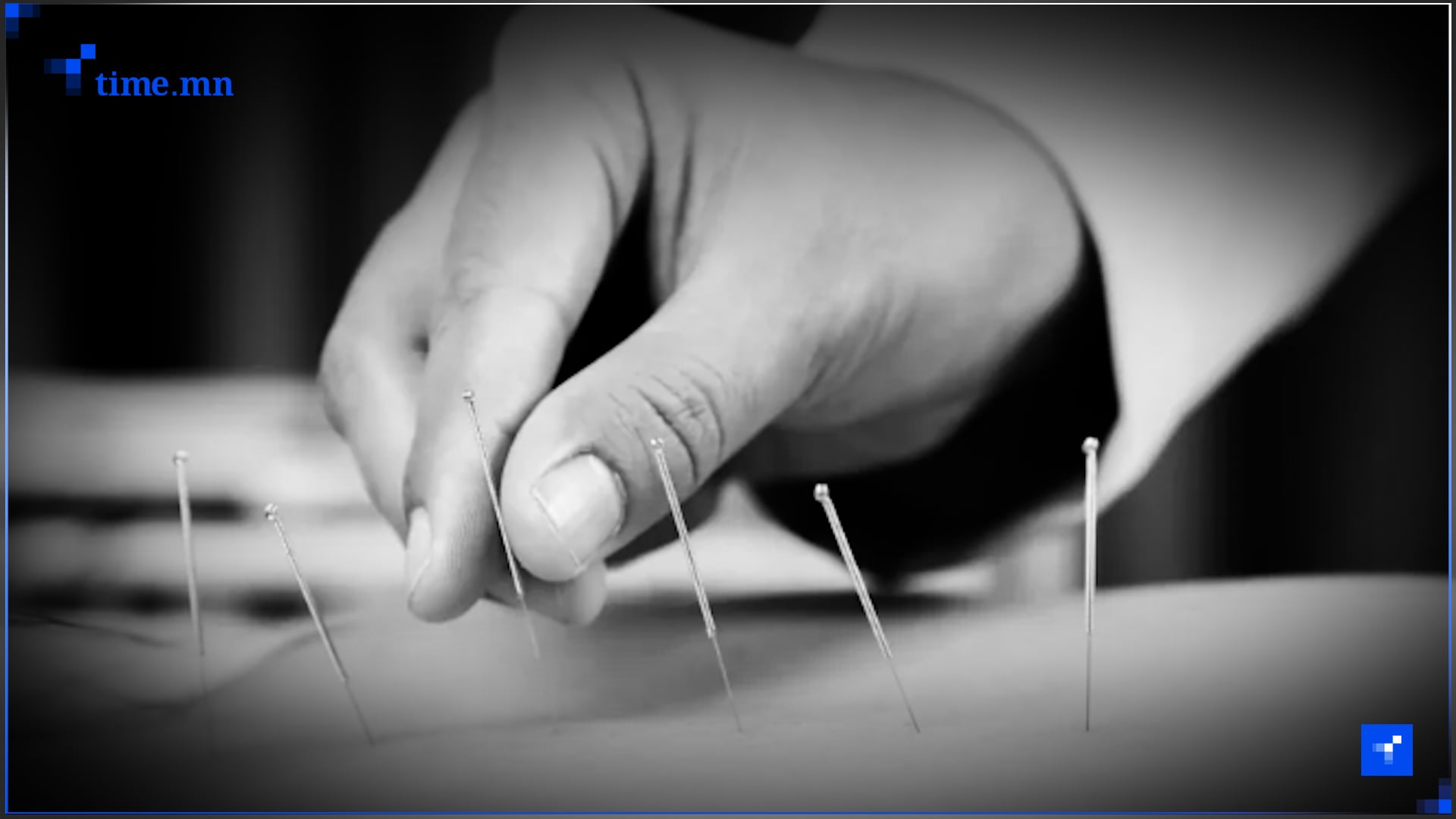 9 жил хараагүй байсан охинд хараа оруулсан гэх хятад эмч Монголд эмчилгээ хийх эрхгүй байжээ