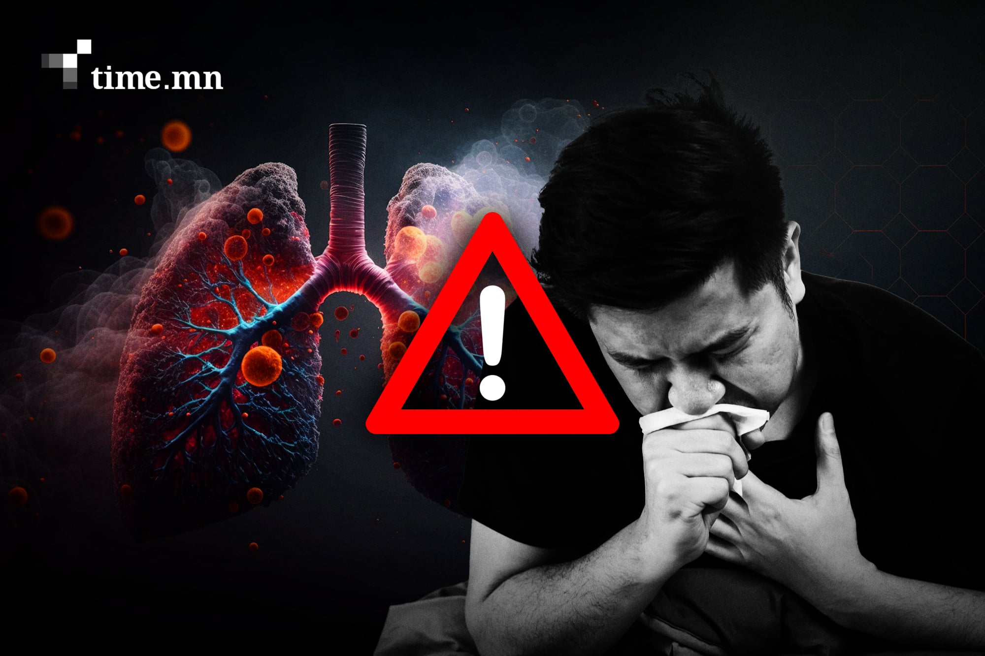 Агааржуулалт муутай албан газрууд сүрьеэгийн үүр болжээ